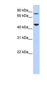 DPH2 antibody LS-C102409 Western blot of 293T cell lysate.