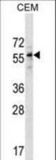 DPH2 Antibody western blot of CEM cell line lysates (35 ug/lane). The DPH2 antibody detected the DPH2 protein (arrow).
