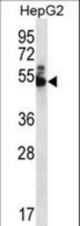 WDR85 Antibody western blot of HepG2 cell line lysates (35 ug/lane). The WDR85 antibody detected the WDR85 protein (arrow).