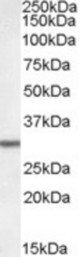 Antibody (0.05 ug/ml) staining of Rat Liver lysate (35 ug protein in RIPA buffer). Primary incubation was 1 hour. Detected by chemiluminescence