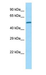 DPP2 / DPP7 antibody Western Blot of 721_B.