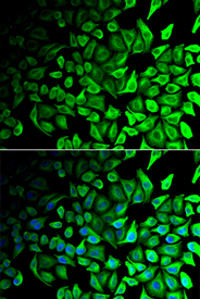 Immunofluorescence analysis of HeLa cell using DPP7 antibody. Blue: DAPI for nuclear staining.
