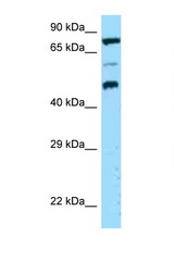 DPP4 / CD26 antibody LS-C146475 Western blot of HCT15 Cell lysate. Antibody concentration 1 ug/ml.