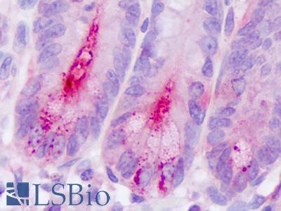 Anti-DPP4 / CD26 antibody IHC of human small intestine, crypt. Immunohistochemistry of formalin-fixed, paraffin-embedded tissue after heat-induced antigen retrieval. Antibody LS-A8061 dilution 2.5 ug/ml.