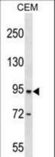 DPP4 Antibody western blot of CEM cell line lysates (35 ug/lane). The DPP4 antibody detected the DPP4 protein (arrow).