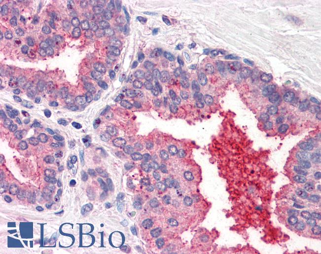 Anti-CD26 antibody LS-A9025 IHC of human prostate. Immunohistochemistry of formalin-fixed, paraffin-embedded tissue after heat-induced antigen retrieval.
