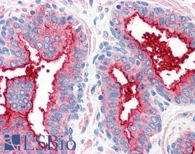 Anti-CD26 antibody LS-A9024 IHC of human prostate. Immunohistochemistry of formalin-fixed, paraffin-embedded tissue after heat-induced antigen retrieval.