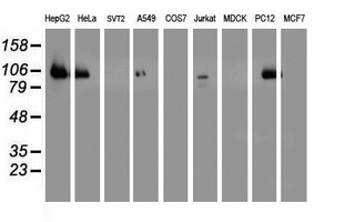 Western blot of extracts (35 ug) from 9 different cell lines by using anti-DPP9 monoclonal antibody.