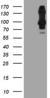 HEK293T cells were transfected with the pCMV6-ENTRY control (Left lane) or pCMV6-ENTRY DPP9 (Right lane) cDNA for 48 hrs and lysed. Equivalent amounts of cell lysates (5 ug per lane) were separated by SDS-PAGE and immunoblotted with anti-DPP9.