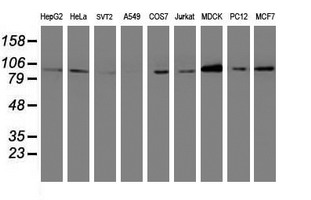 Western blot of extracts (35 ug) from 9 different cell lines by using anti-DPP9 monoclonal antibody.