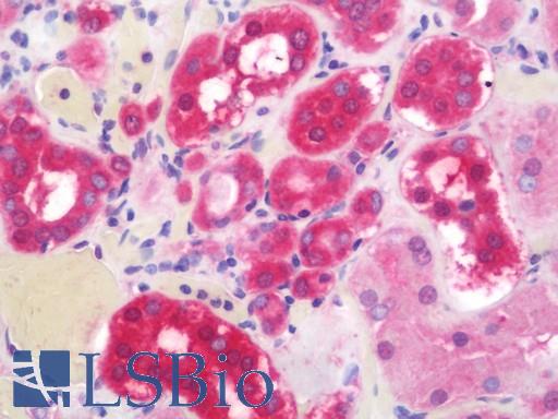Anti-DPP9 antibody IHC staining of human kidney. Immunohistochemistry of formalin-fixed, paraffin-embedded tissue after heat-induced antigen retrieval. Antibody LS-B11155 concentration 10 ug/ml.