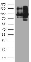 HEK293T cells were transfected with the pCMV6-ENTRY control (Left lane) or pCMV6-ENTRY DPP9 (Right lane) cDNA for 48 hrs and lysed. Equivalent amounts of cell lysates (5 ug per lane) were separated by SDS-PAGE and immunoblotted with anti-DPP9.