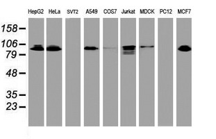 Western blot of extracts (35 ug) from 9 different cell lines by using anti-DPP9 monoclonal antibody.