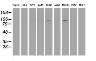 Western blot of extracts (35 ug) from 9 different cell lines by using anti-DPP9 monoclonal antibody.