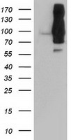 HEK293T cells were transfected with the pCMV6-ENTRY control (Left lane) or pCMV6-ENTRY DPP9 (Right lane) cDNA for 48 hrs and lysed. Equivalent amounts of cell lysates (5 ug per lane) were separated by SDS-PAGE and immunoblotted with anti-DPP9.