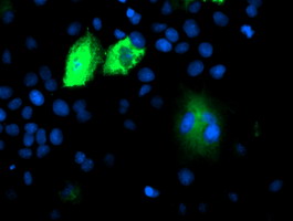 Anti-DPP9 mouse monoclonal antibody immunofluorescent staining of COS7 cells transiently transfected by pCMV6-ENTRY DPP9.