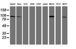 Western blot of extracts (35 ug) from 9 different cell lines by using anti-DPP9 monoclonal antibody.