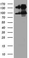 HEK293T cells were transfected with the pCMV6-ENTRY control (Left lane) or pCMV6-ENTRY DPP9 (Right lane) cDNA for 48 hrs and lysed. Equivalent amounts of cell lysates (5 ug per lane) were separated by SDS-PAGE and immunoblotted with anti-DPP9.