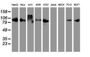 Western blot of extracts (35 ug) from 9 different cell lines by using anti-DPP9 monoclonal antibody.