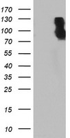 HEK293T cells were transfected with the pCMV6-ENTRY control (Left lane) or pCMV6-ENTRY DPP9 (Right lane) cDNA for 48 hrs and lysed. Equivalent amounts of cell lysates (5 ug per lane) were separated by SDS-PAGE and immunoblotted with anti-DPP9.
