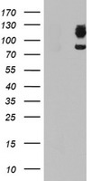 HEK293T cells were transfected with the pCMV6-ENTRY control (Left lane) or pCMV6-ENTRY DPP9 (Right lane) cDNA for 48 hrs and lysed. Equivalent amounts of cell lysates (5 ug per lane) were separated by SDS-PAGE and immunoblotted with anti-DPP9.