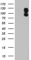 HEK293T cells were transfected with the pCMV6-ENTRY control (Left lane) or pCMV6-ENTRY DPP9 (Right lane) cDNA for 48 hrs and lysed. Equivalent amounts of cell lysates (5 ug per lane) were separated by SDS-PAGE and immunoblotted with anti-DPP9.
