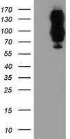 HEK293T cells were transfected with the pCMV6-ENTRY control (Left lane) or pCMV6-ENTRY DPP9 (Right lane) cDNA for 48 hrs and lysed. Equivalent amounts of cell lysates (5 ug per lane) were separated by SDS-PAGE and immunoblotted with anti-DPP9.