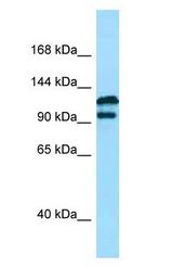 DPP9 antibody Western Blot of MCF7.