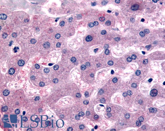 Anti-DPP9 antibody LS-A8308 IHC of human liver. Immunohistochemistry of formalin-fixed, paraffin-embedded tissue after heat-induced antigen retrieval.
