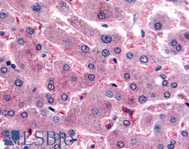 Anti-DPP9 antibody LS-A8307 IHC of human liver. Immunohistochemistry of formalin-fixed, paraffin-embedded tissue after heat-induced antigen retrieval.