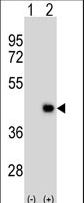 Western blot of DPPA2 (arrow) using rabbit polyclonal DPPA2 Antibody. 293 cell lysates (2 ug/lane) either nontransfected (Lane 1) or transiently transfected (Lane 2) with the DPPA2 gene.