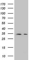 HEK293T cells were transfected with the pCMV6-ENTRY control (Left lane) or pCMV6-ENTRY DPPA2 (Right lane) cDNA for 48 hrs and lysed. Equivalent amounts of cell lysates (5 ug per lane) were separated by SDS-PAGE and immunoblotted with anti-DPPA2.