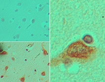 IHC of STELLAR in formalin-fixed, paraffin-embedded human brain tissue using an isotype control (top) and LS-C148711 (bottom) at 5 ug/ml.