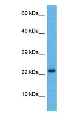 Western blot of DPPA3 Antibody with human Breast Tumor lysate.