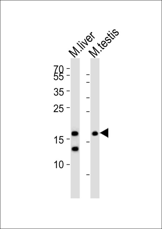 Western blot of lysates from mouse liver, mouse testis tissue (from left to right) with (Mouse) Dppa3 Antibody. Antibody was diluted at 1:1000 at each lane. A goat anti-rabbit IgG H&L (HRP) at 1:10000 dilution was used as the secondary antibody. Lysates at 20 ug per lane.