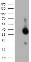 HEK293T cells were transfected with the pCMV6-ENTRY control (Left lane) or pCMV6-ENTRY DPPA4 (Right lane) cDNA for 48 hrs and lysed. Equivalent amounts of cell lysates (5 ug per lane) were separated by SDS-PAGE and immunoblotted with anti-DPPA4.