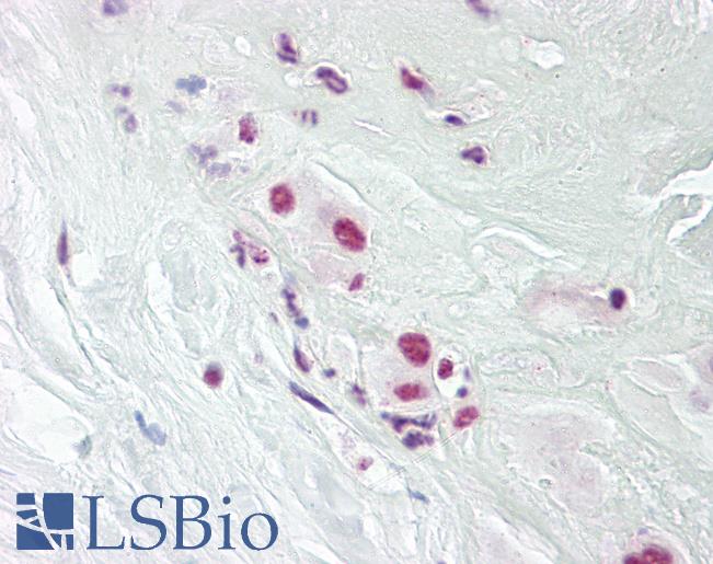 Anti-DPPA4 antibody IHC of human placenta. Immunohistochemistry of formalin-fixed, paraffin-embedded tissue after heat-induced antigen retrieval. Antibody LS-B7998 dilution 5-10 ug/ml.