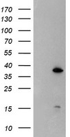 HEK293T cells were transfected with the pCMV6-ENTRY control (Left lane) or pCMV6-ENTRY DPPA4 (Right lane) cDNA for 48 hrs and lysed. Equivalent amounts of cell lysates (5 ug per lane) were separated by SDS-PAGE and immunoblotted with anti-DPPA4.