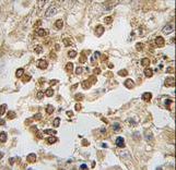 Formalin-fixed and paraffin-embedded human testis tissue reacted with DPPA4 antibody , which was peroxidase-conjugated to the secondary antibody, followed by DAB staining. This data demonstrates the use of this antibody for immunohistochemistry; clinical relevance has not been evaluated.