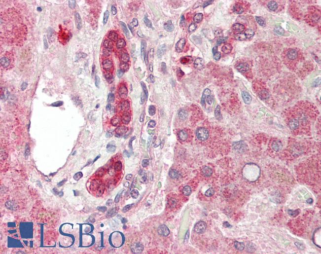 Human Liver: Formalin-Fixed, Paraffin-Embedded (FFPE)