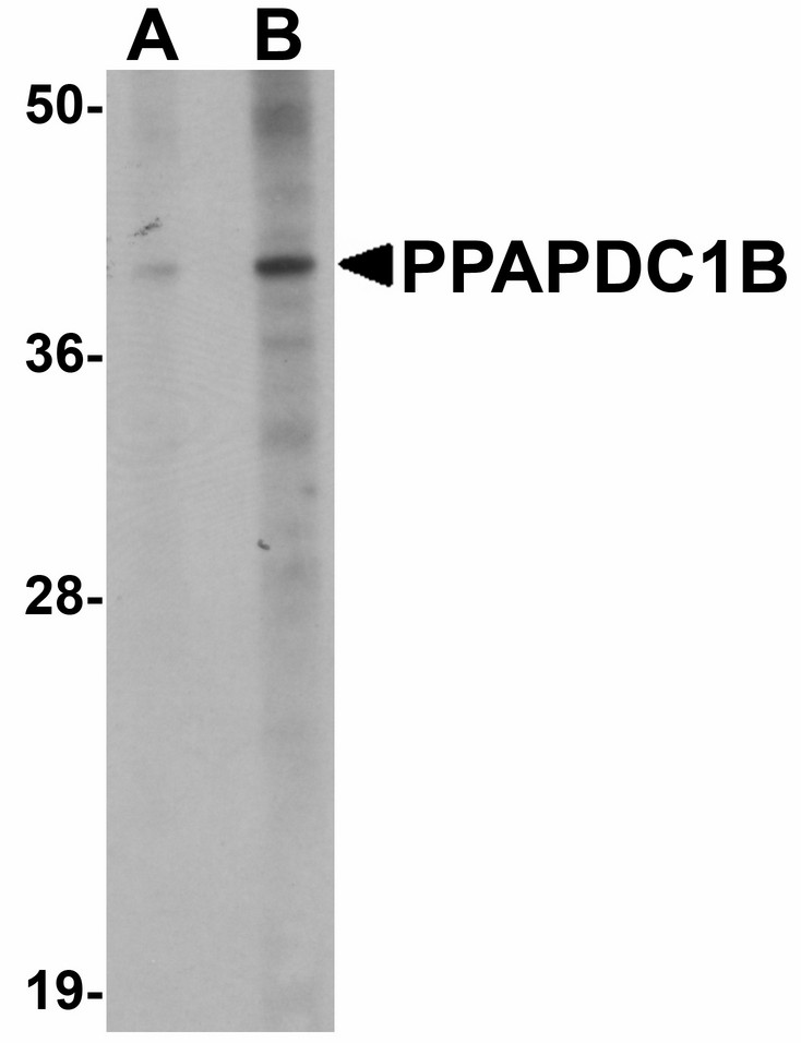 Western blot of PPAPDC1B in EL4 cell lysate with PPAPDC1B antibody at (A) 1 and (B) 2 ug/ml.