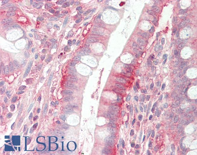 Anti-DPY19L1 antibody IHC staining of human small intestine. Immunohistochemistry of formalin-fixed, paraffin-embedded tissue after heat-induced antigen retrieval. Antibody LS-B9737 concentration 10 ug/ml.