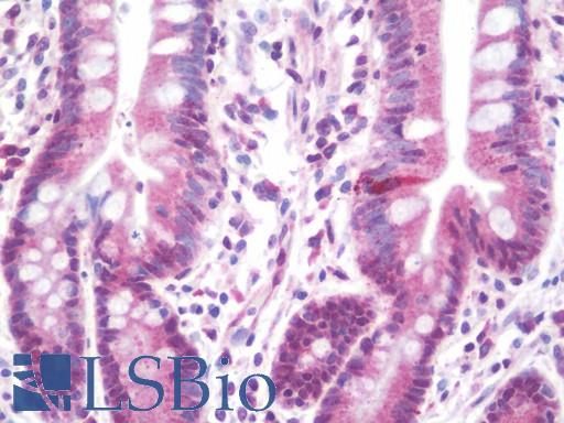 Anti-DPY19L1 antibody IHC staining of human small intestine. Immunohistochemistry of formalin-fixed, paraffin-embedded tissue after heat-induced antigen retrieval. Antibody LS-B10534 dilution 1:100.
