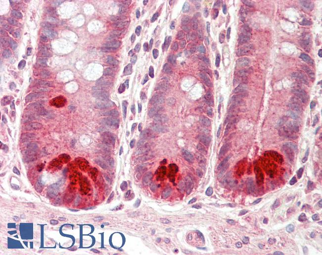 Anti-DPY19L1 antibody IHC staining of human small intestine. Immunohistochemistry of formalin-fixed, paraffin-embedded tissue after heat-induced antigen retrieval. Antibody LS-B9738 concentration 10 ug/ml.