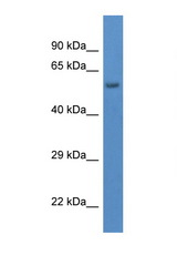 DPY19L1 antibody Western blot of Mouse Brain lysate. Antibody concentration 1 ug/ml.