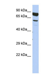 DPY19L4 antibody LS-C111712 Western blot of Fetal Thymus lysate.