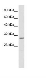 Jurkat Cell Lysate