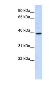 CHIA / Amcase antibody LS-C101980 Western blot of HeLa lysate.