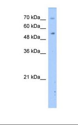 Transfected 293T cell lysate. Antibody concentration: 2.5 ug/ml. Gel concentration: 12%.