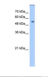 Transfected 293T cell lysate. Antibody concentration: 1.25 ug/ml. Gel concentration: 12%.